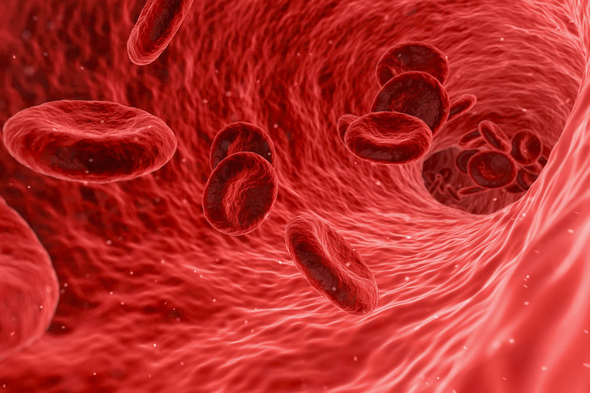 26 Fakta Tentang Anemia