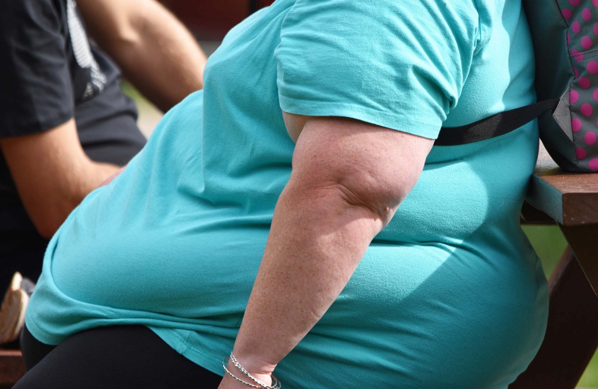 38 Fakta Tentang Obesiti