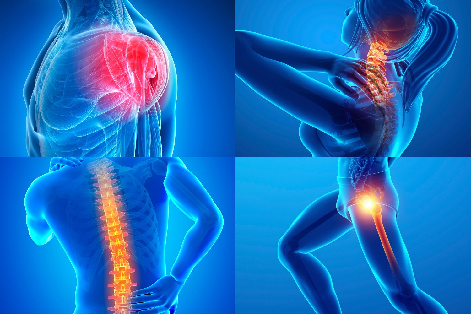 40 Fakta Tentang Fibromyalgia